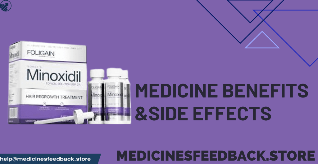 Top-Benefits-of-Minoxidil-and-What-Side-Effects-You-Should-Knows